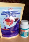 Full Prostate Enlargement Kit